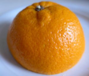 Bindegewebsschwäche