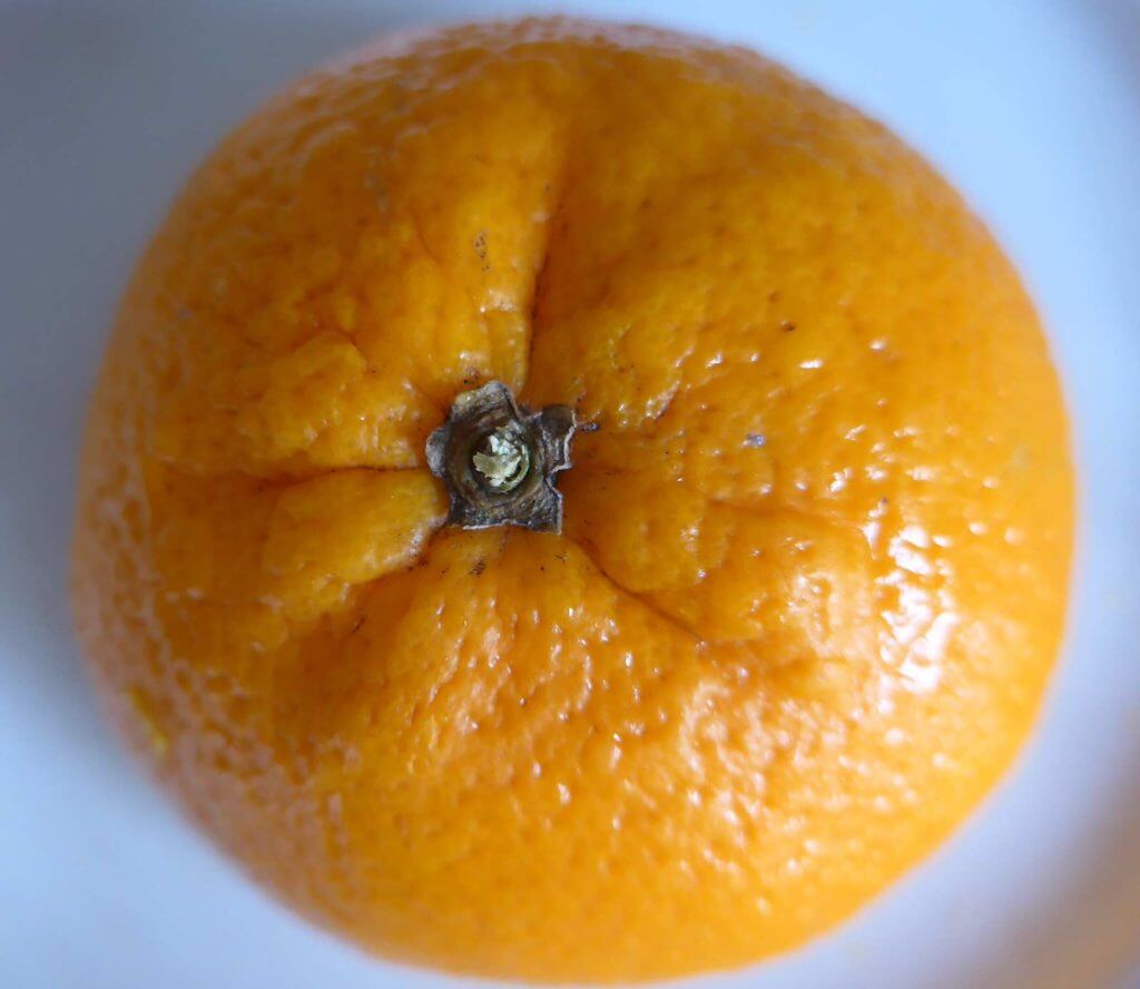 Wasser im Bindegewebe Orangenhaut Wasser im Bindegewebe Orangenhaut