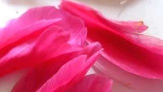 Krankenzusatzversicherung bei Bindegewebsschwäche