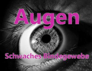 Schwaches Bindegewebe Augen können betroffen sein Erklärungen vom Augenarzt
